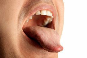 Celebrities Suffer from Bad Breath, Too! | NH Dentistry Beverly Hills
